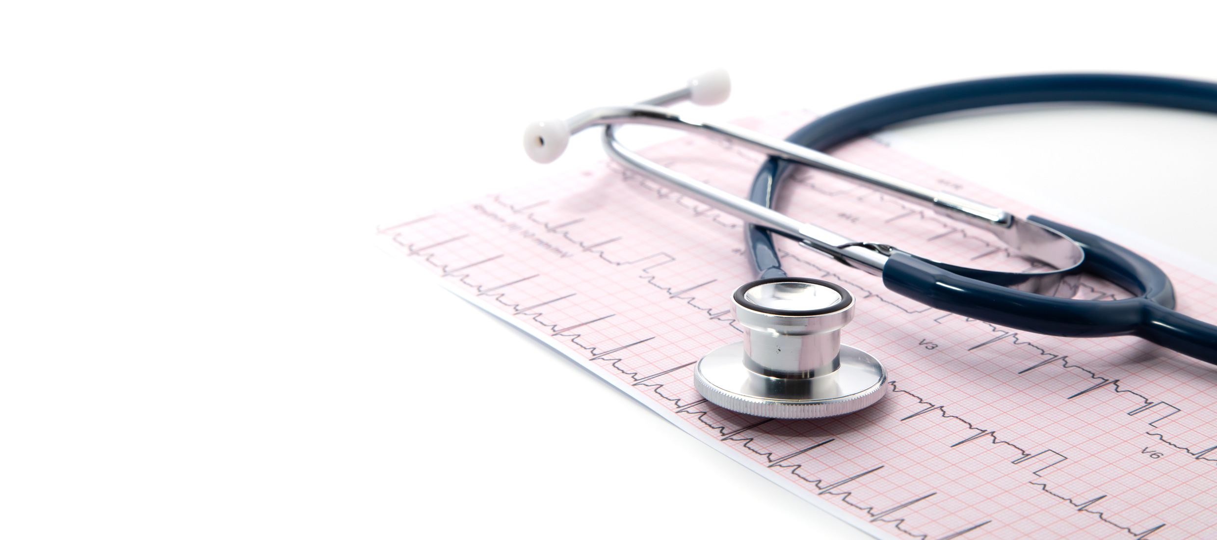 A stethoscope sits atop an electrocardiogram printout of heartbeat waves on pink paper
