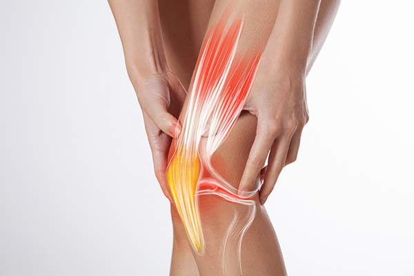 A graphic overlay of knee muscles and tendons on a knee.