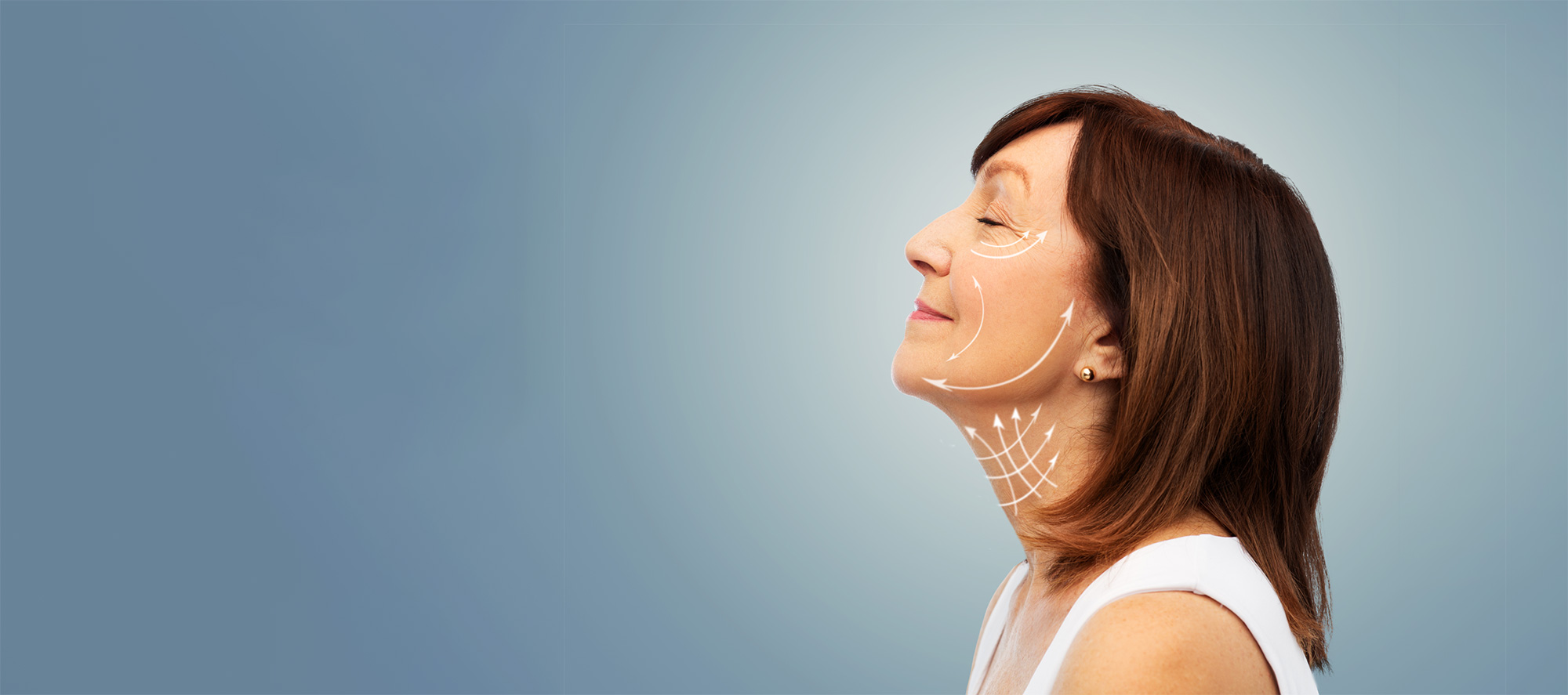Woman with preoperative surgical markings on her face