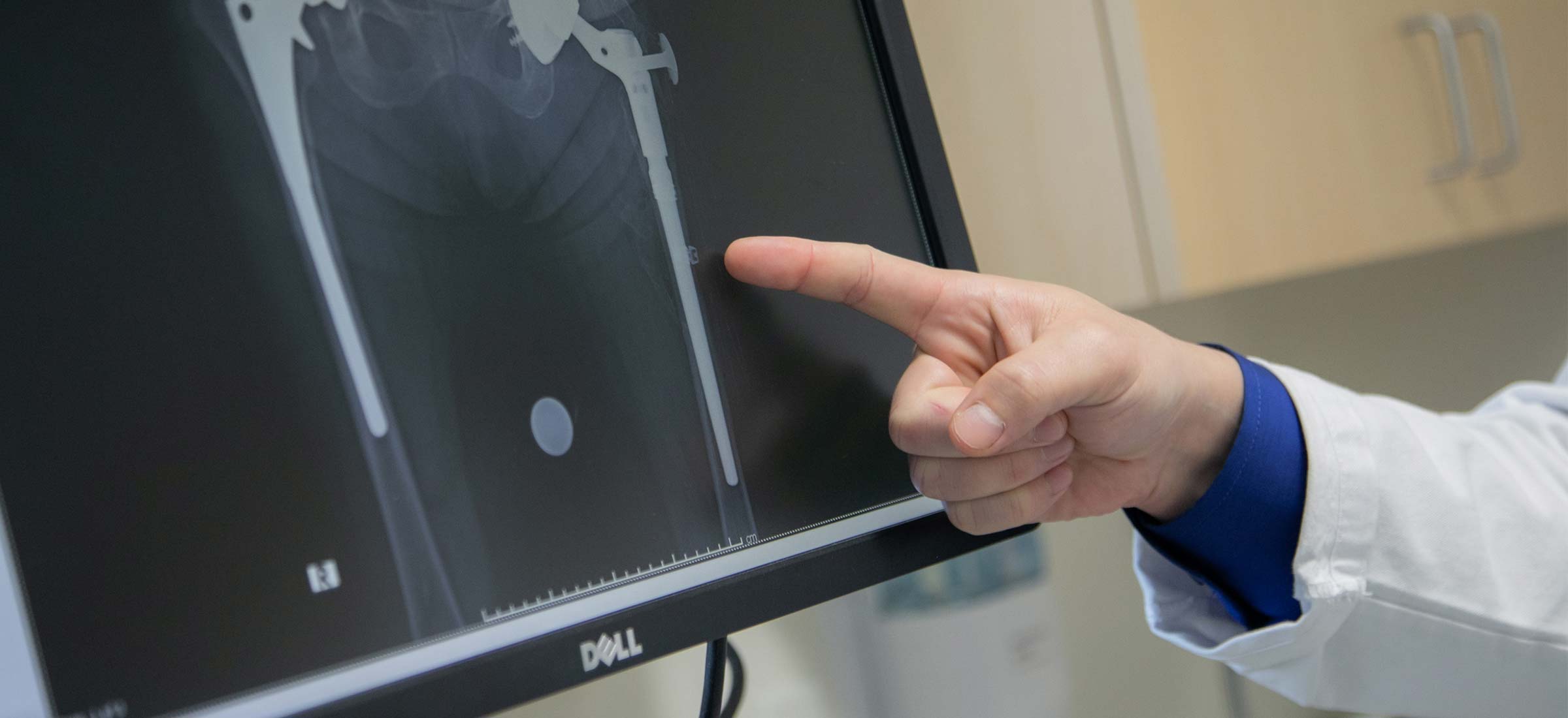 Nathanael Heckmann, MD, a Keck Medicine of USC expert on performing arts injuries points to a bone X-ray on a computer screen.