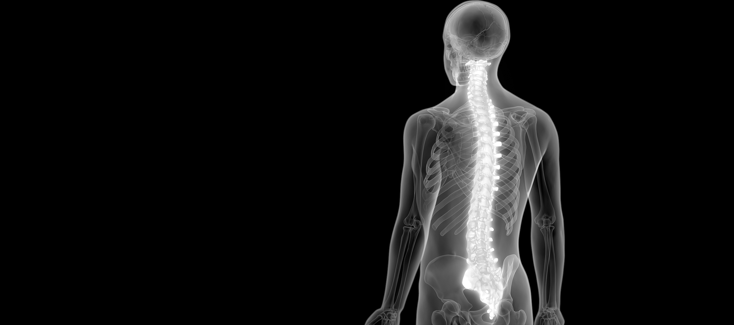 A rendering of the back side of a male torso, against a black background, shows where spinal fusion surgery occurs