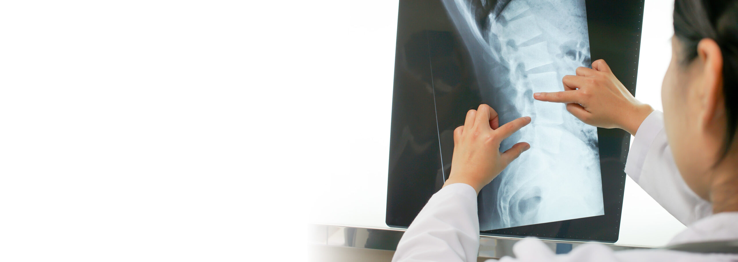 spine back care hero
