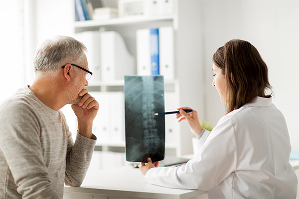A female doctor holds a male patient's xray up at a table and they discuss results.