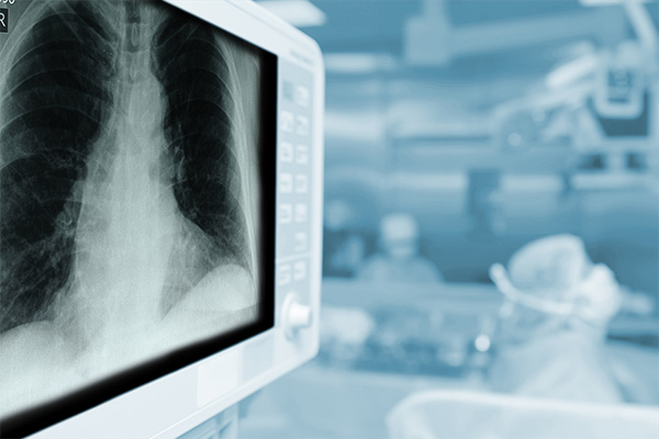 A monitor shows an X-Ray of a chest.
