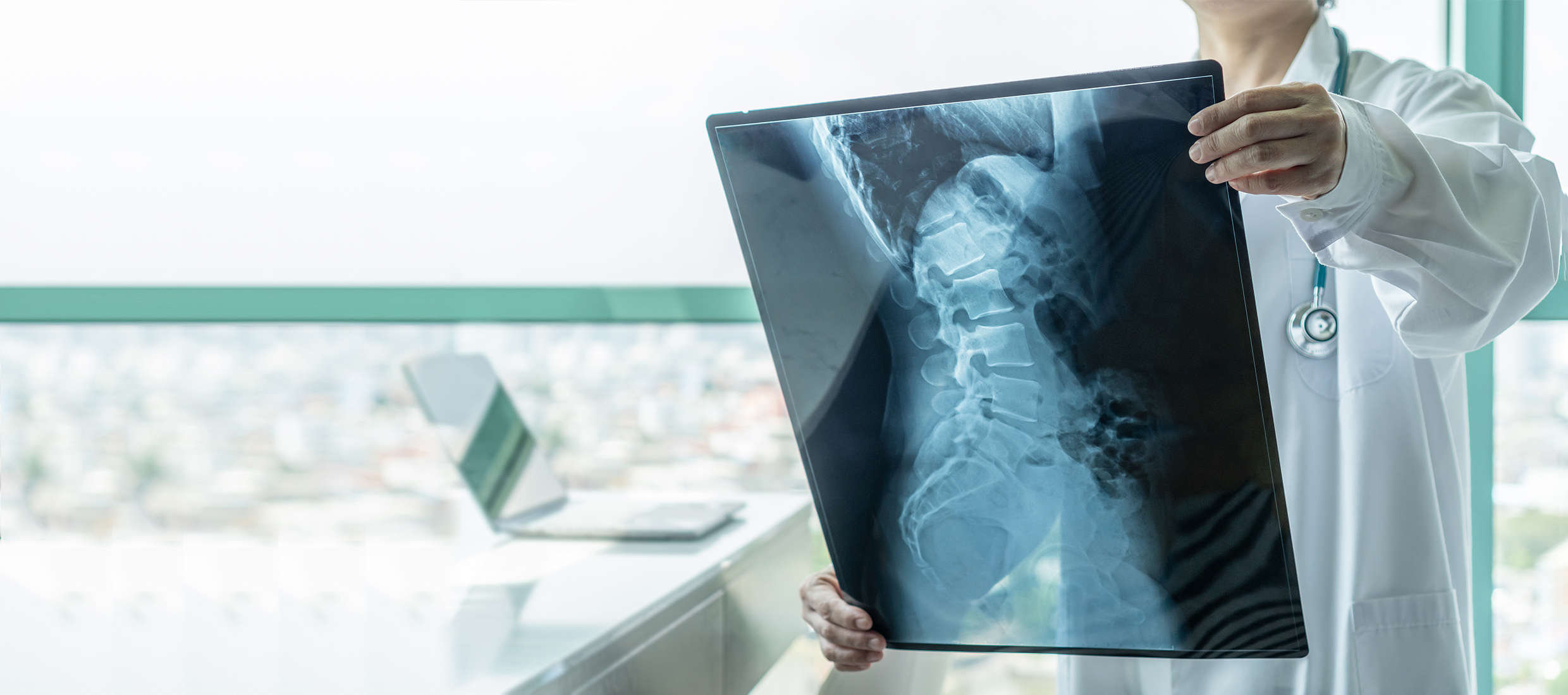 A Keck Medicine specialist holds up a large X-ray of a spine and chordoma