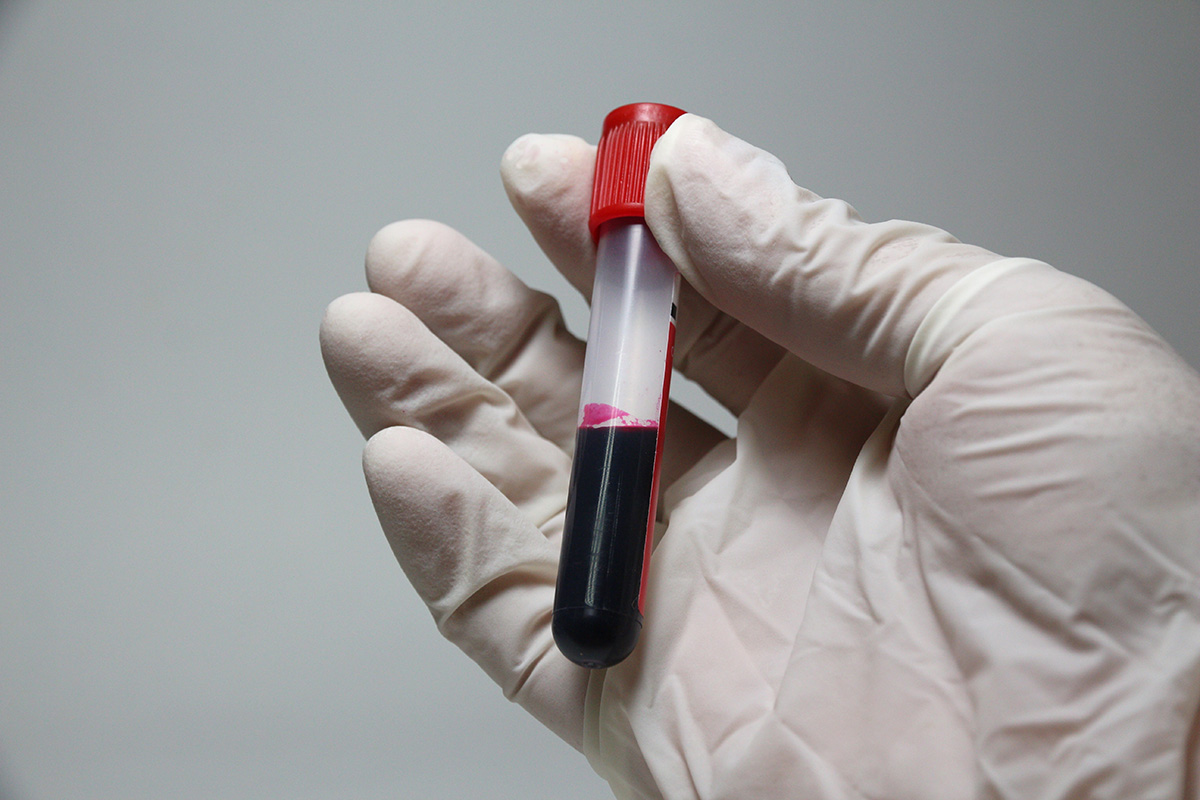 Gloved hand holding a blood vial