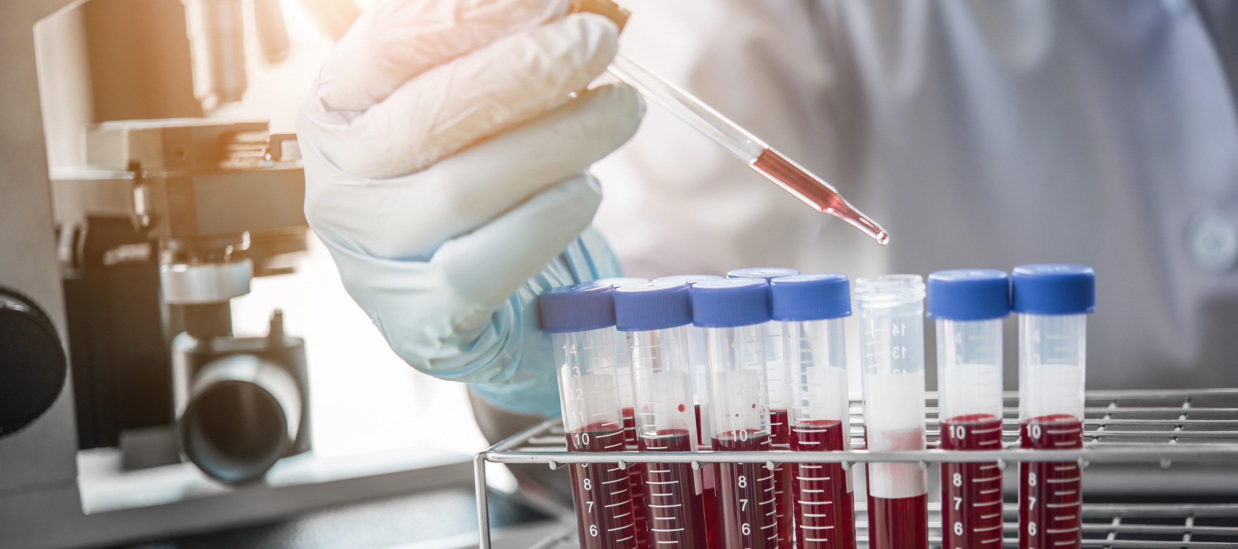 Gloved hand of a scientist working with multiple blood samples in a laboratory