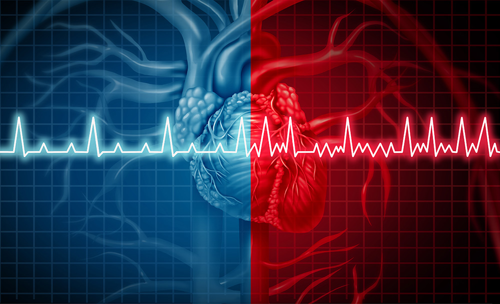 For Some AFib Patients, Minimally Invasive Surgery Should Be Discussed