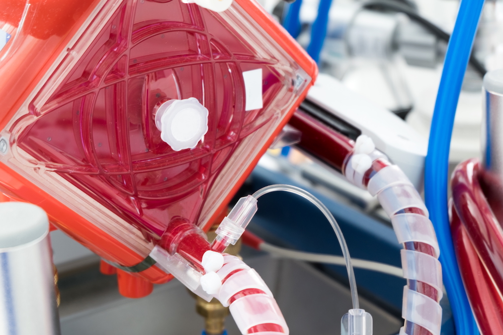 How Normothermic Perfusion Is Expanding the Liver Transplant Pool