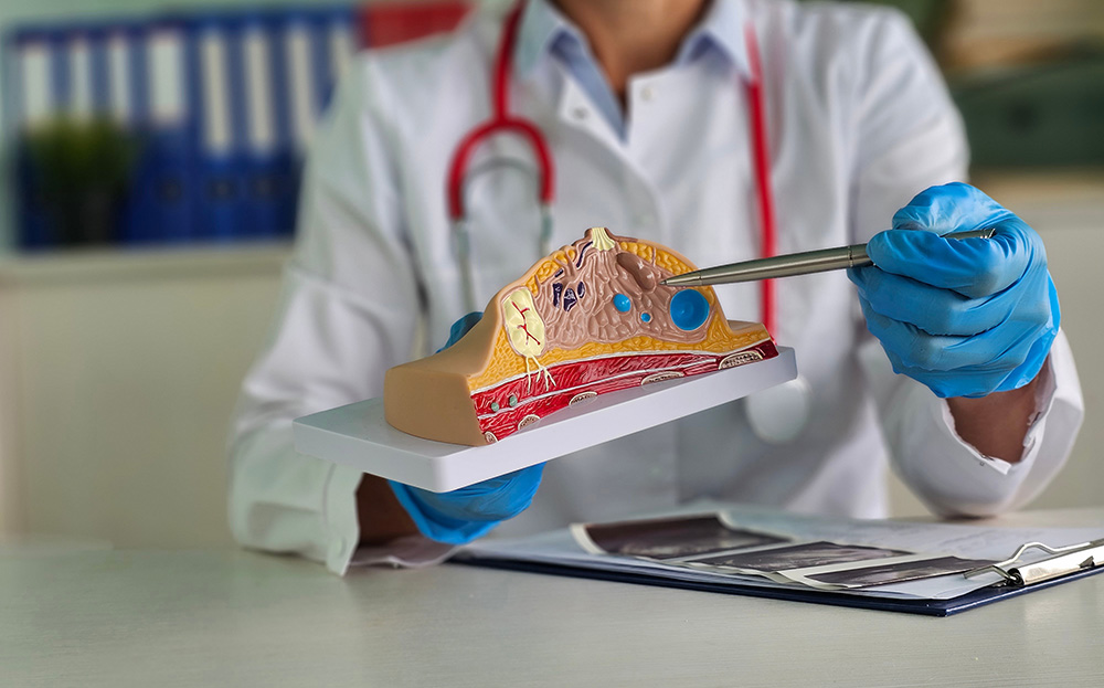 Cancer Surgery: How Can Doctors Set Realistic Patient Expectations About Results?