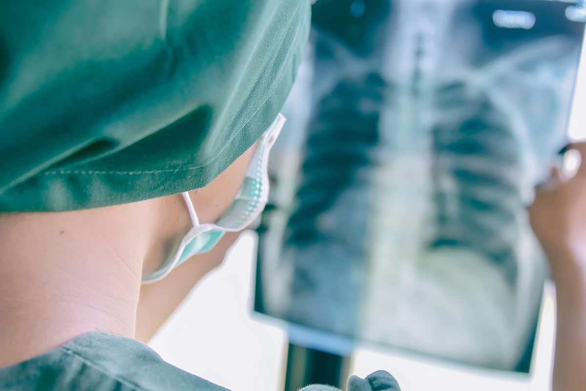 A surgeon holds up a chest x-ray.