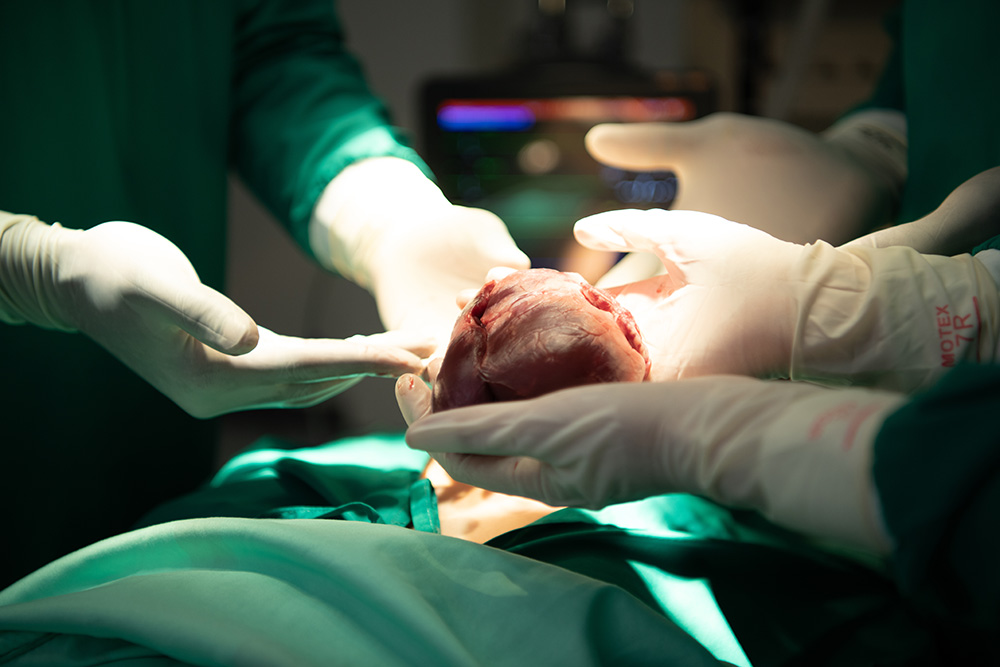 The Heart Donation Advances Shortening the Transplant Wait List