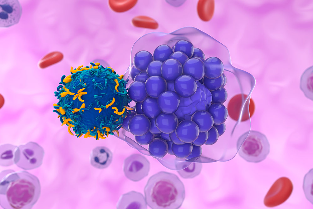 Why CAR-T Cell Therapy Struggles Against Solid Tumors
