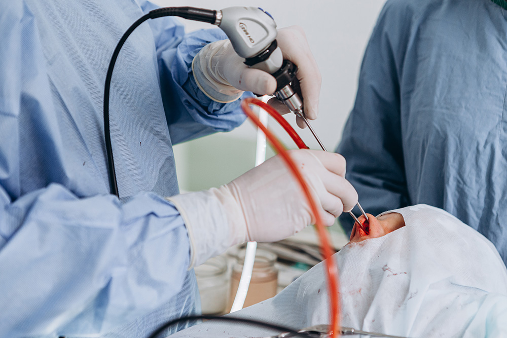 Sinus Surgery: When Is Earlier Intervention Beneficial?